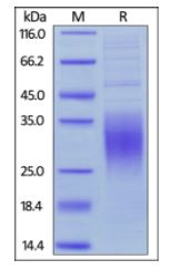 Human BTLA, His Tag on SDS-PAGE under reducing (R) condition. The gel was stained overnight with Coomassie Blue. The purity of the protein is greater than 90%.